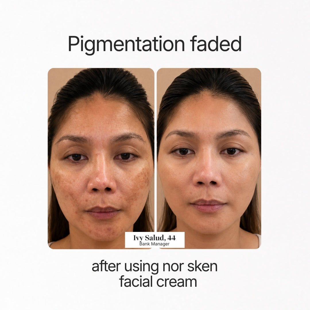 nor sken restore facial cream