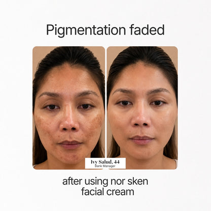 nor sken restore facial cream