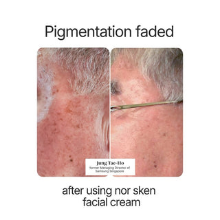 nor sken restore facial cream