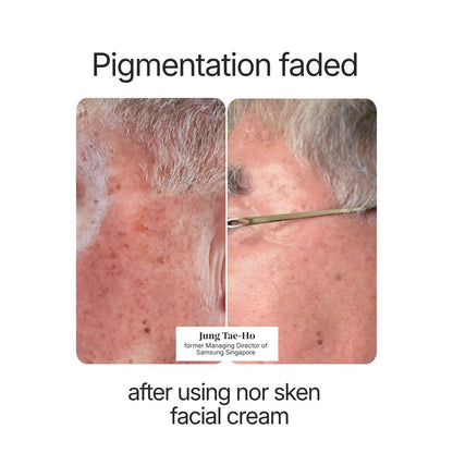 nor sken restore facial cream