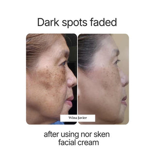 nor sken restore facial cream