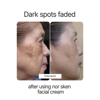 nor sken restore facial cream
